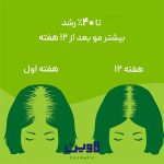 قرص تقویت مو و ضد ریزش مو پریورین اورجینال