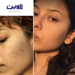 فوم شستشو صورت پوست نرمال تا چرب سراوی