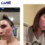 فوم شستشو صورت پوست نرمال تا چرب سراوی