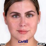 پرایمر پوشاننده منافذ باز بنفیت مدل پروفشنال
