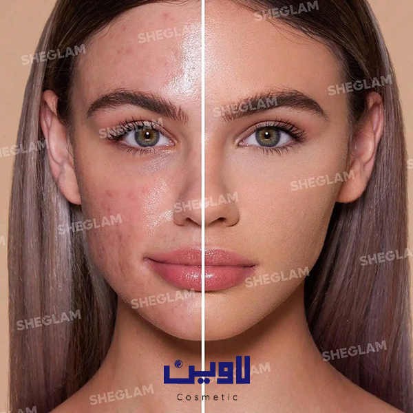 پنکیک شیگلم رنگ نود